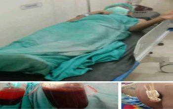 Pelaku Penusukan Siswa SMA Belum Ditahan, Polres Bima Tuai Kecaman